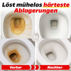 1x Urinsteinentferner 1L